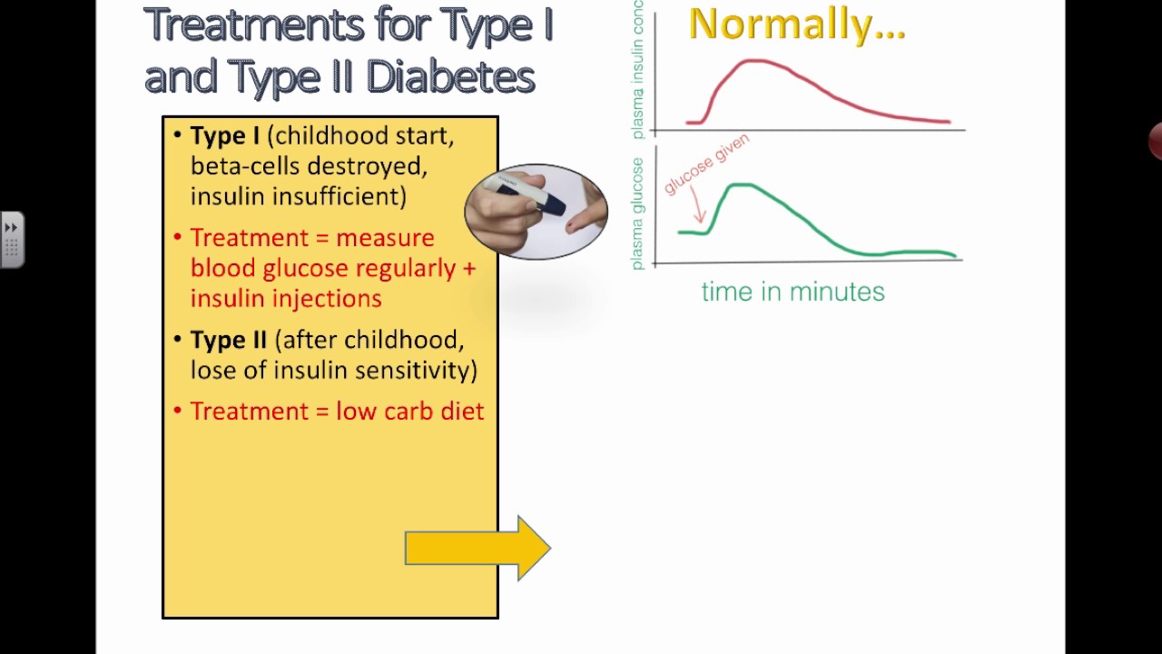 You are currently viewing Treatments for Type I and Type II Diabetes (IB Biology 2014)
