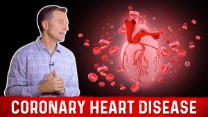 Two Causes of Coronary Heart Disease (It’s Not Saturated Fat) | Dr.Berg