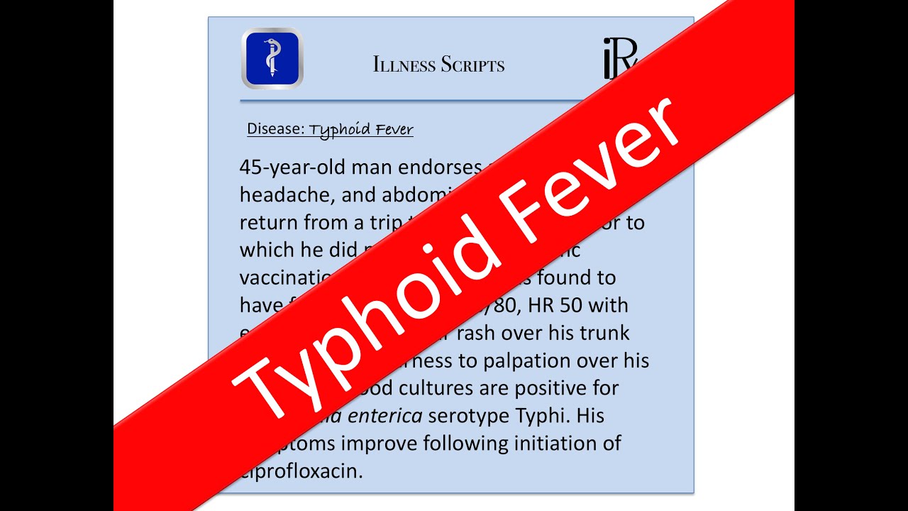 You are currently viewing Typhoid Fever Illness Script – USMLE, Medicine Board Review