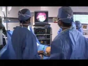 Organ Transplantation Surgeries Video – 5