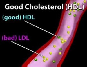 Understanding Cholesterol (Cholesterol #1)