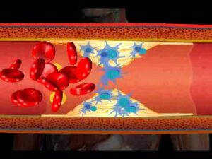 Understanding Cholesterol and its Effects