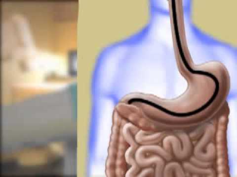 You are currently viewing Gastroenterology Video – 4