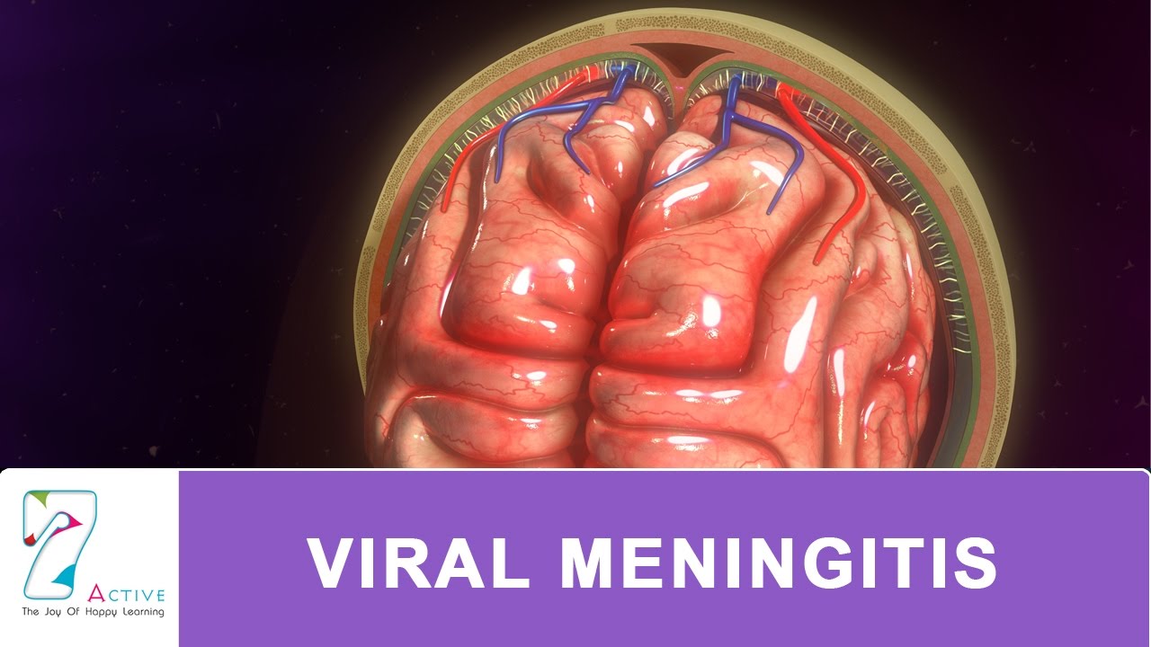 You are currently viewing VIRAL MENINGITIS