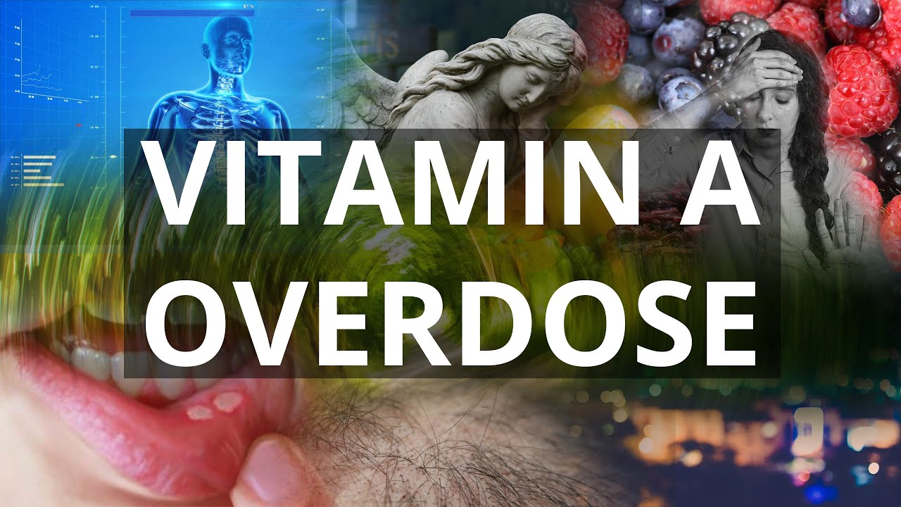 You are currently viewing Hypervitaminosis Video – 2