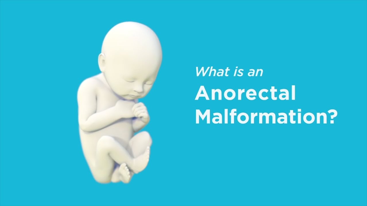 You are currently viewing Anorectal Surgeries Video – 2