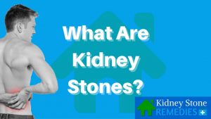 Read more about the article What Are Kidney Stones – Kidney Stone Home Remedies