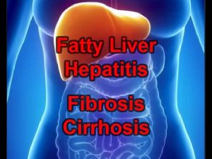Read more about the article What Are the Stages of Liver Damage? Fatty Liver|Hepatitis|Fibrosis|Cirrhosis