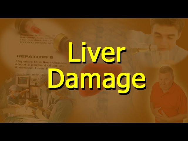 You are currently viewing What Causes Liver Damage?