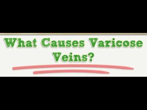 Read more about the article What Causes Varicose Veins?