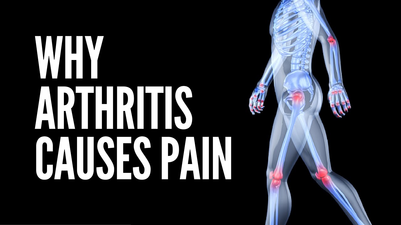 You are currently viewing What Is Arthritis | What Causes Arthritis | Why Arthritis Causes Pain