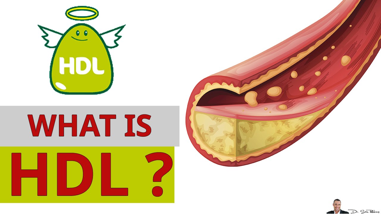 You are currently viewing What Is HDL Cholesterol & Why it’s Called The Good Cholesterol? – by Dr Sam Robbins