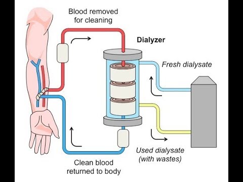 You are currently viewing What Is Kidney Dialysis?