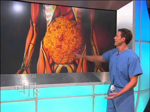 You are currently viewing What Visceral Fat Does To The Body (The Doctors)