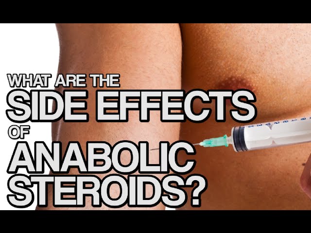 You are currently viewing Anabolic Steroids – History, Definition, Use & Abuse Video – 16