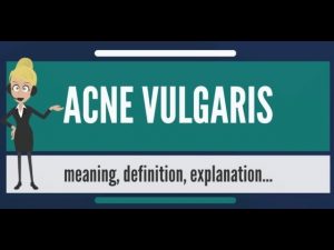 Read more about the article What is ACNE VULGARIS? What does ACNE VULGARIS mean? ACNE VULGARIS meaning & explanation