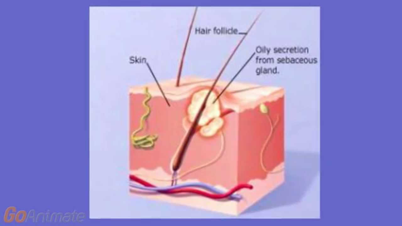 You are currently viewing What is Acne and What is the Best Acne Treatment?