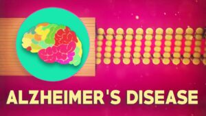 Read more about the article What is Alzheimer’s disease? – Ivan Seah Yu Jun