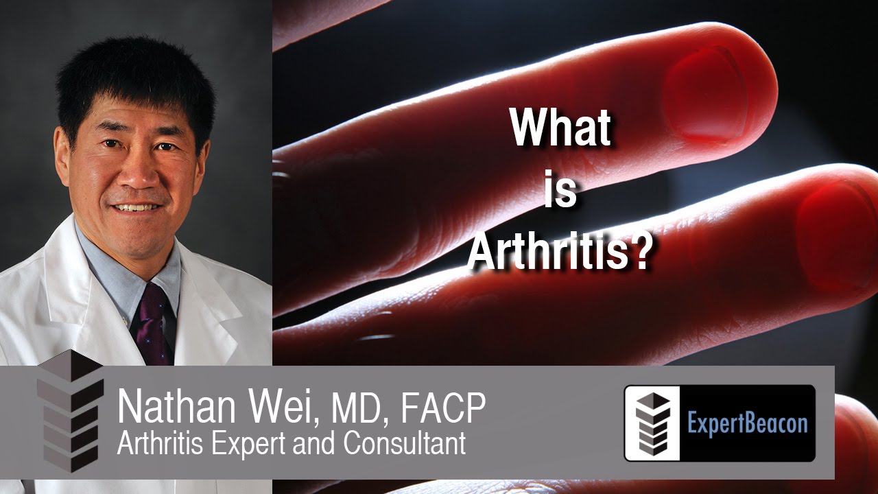 You are currently viewing What is Arthritis?