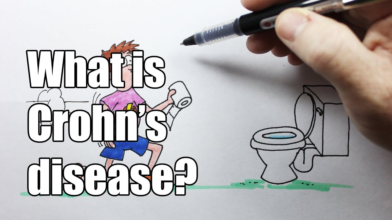You are currently viewing What is Crohn’s disease?