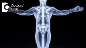 Read more about the article What is Osteoporosis? – Dr. Anantharaman Ramakrishnan