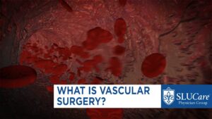 Read more about the article Vascular Surgery Video – 5