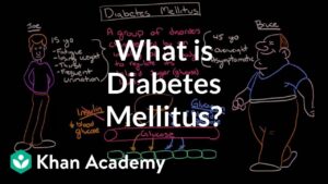 Endocrine System Diabetes And Asanas Video – 3