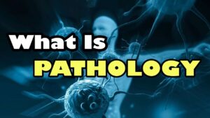Pathology Video – 1