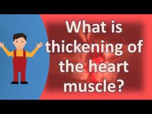What is thickening of the heart muscle ?  | Health FAQS | It’s All about your health