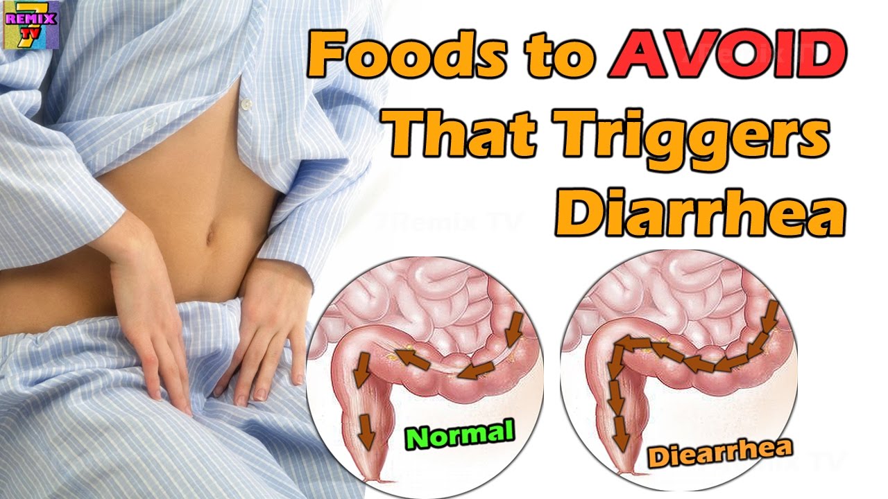 You are currently viewing Worst Foods to Avoid That Spikes Diarrhea Again
