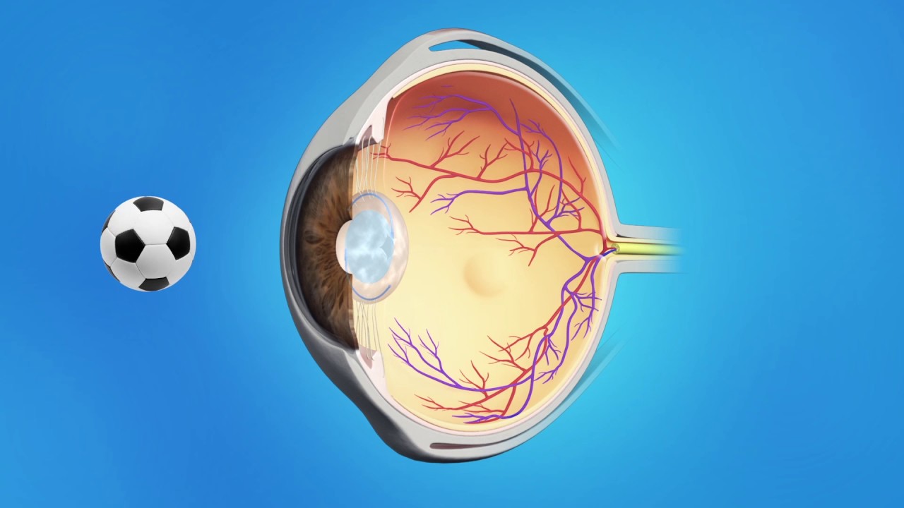You are currently viewing Laser Surgeries Video – 4