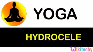 Read more about the article hydrocele | symptoms of | avoid foods | foods taken | acupressure | Exercise |  for hydrocele