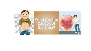 Read more about the article what are cause, symptoms of diarrhea and vomiting and there treatments or precautions