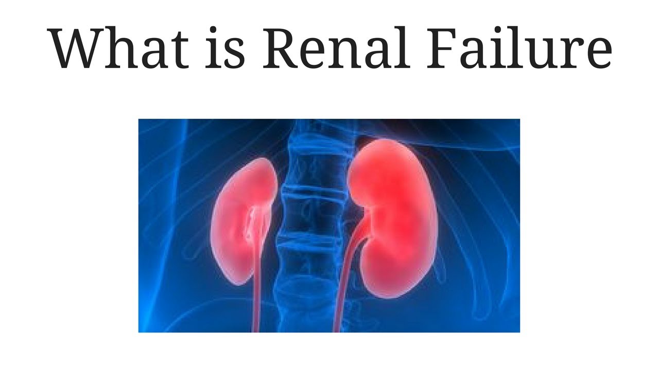 You are currently viewing what is renal failure / Symptoms of kidney failure / chronic & acute kidney failure