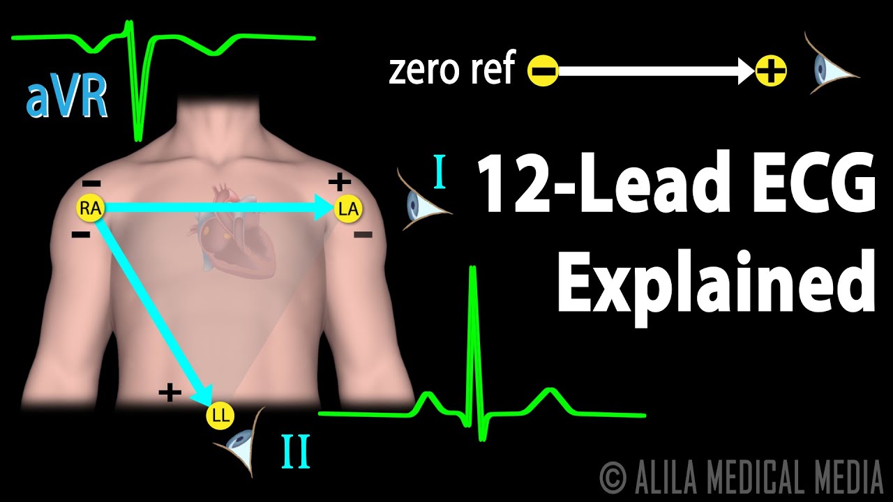 You are currently viewing 12 Lead ECG Explained, Animation