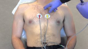 12 Lead ECG Placement example
