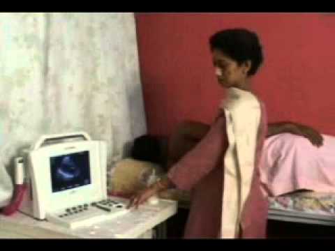 You are currently viewing 2D ECHOCARDIOGRAPHY.wmv