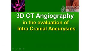 3D CT Angiography  in the evaluation of Intra Cranial Aneurysms – Seminar PPT Presentation