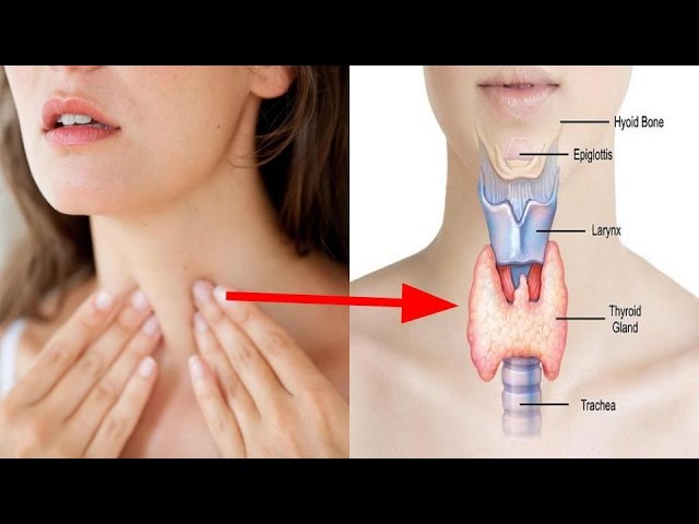 You are currently viewing 6 Foods To Improve Thyroid Function
