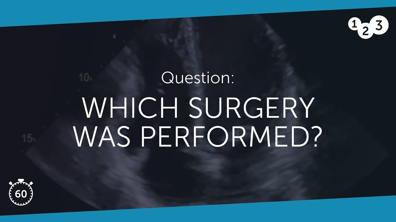 You are currently viewing 60 Seconds of Echo Teaching Question: Which surgery was performed?