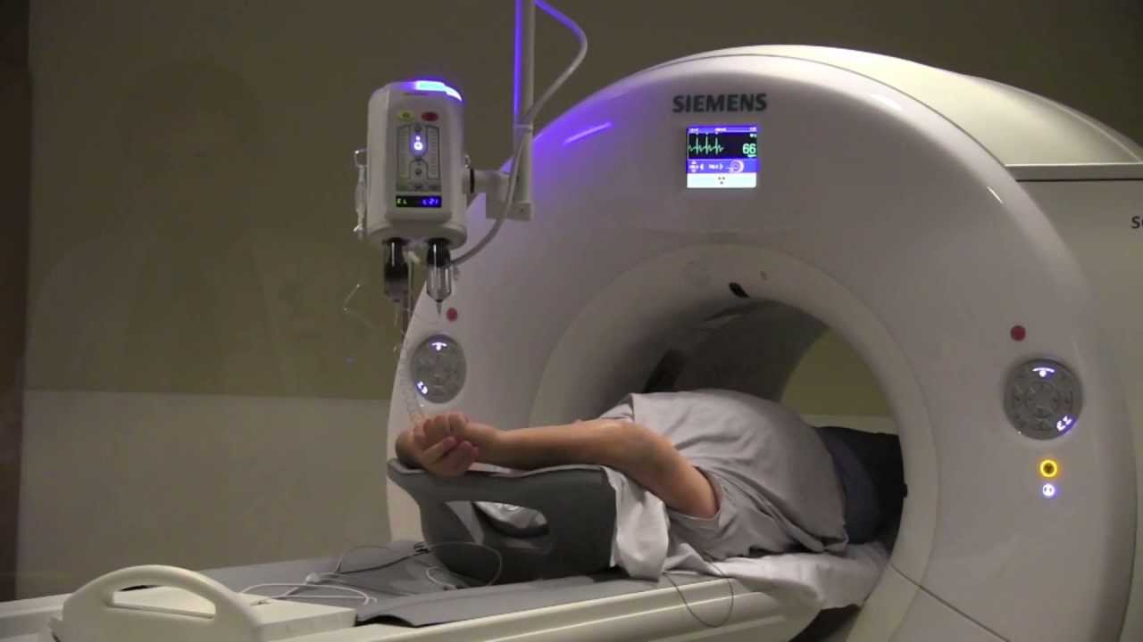 You are currently viewing A Minute for Your Heart – Cardiac CT Scan