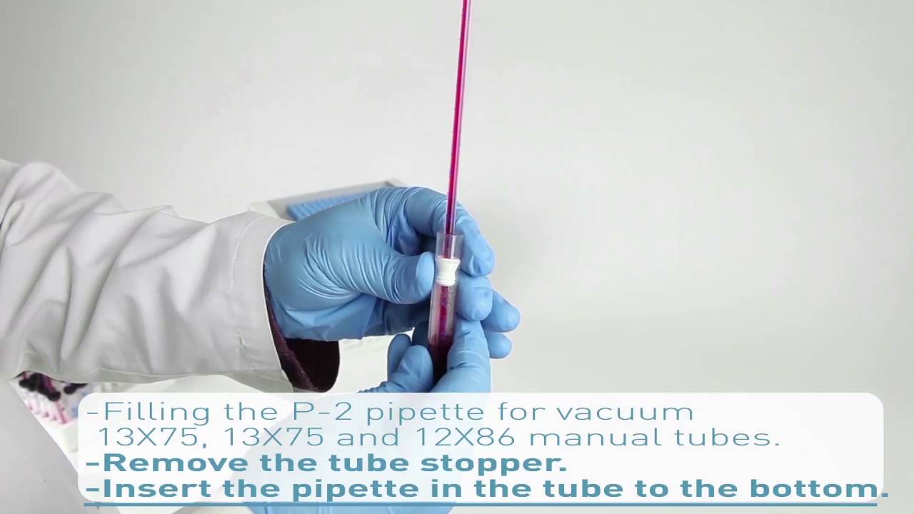 You are currently viewing Aquisel – Tubes and pipettes