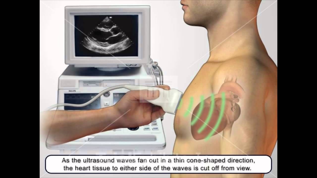 You are currently viewing Basics of Echocardiograms – Medical Animation