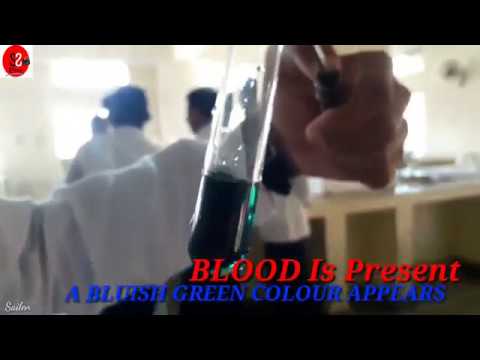 You are currently viewing Blood Benzidine Test | Detection Of Blood In Urine | Urine | Bio-Chemistry