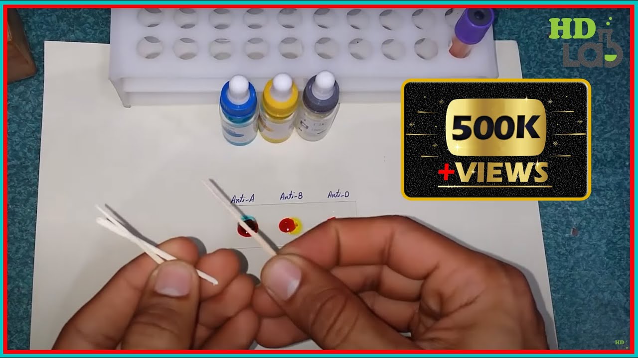 You are currently viewing Blood Group Test  Experiment Harib Diagnostic Lab