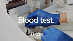 Read more about the article Blood Test Procedure | Nuffield Health