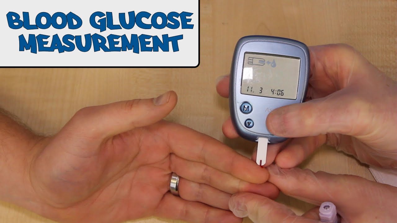 You are currently viewing Blood glucose measurement – OSCE Guide