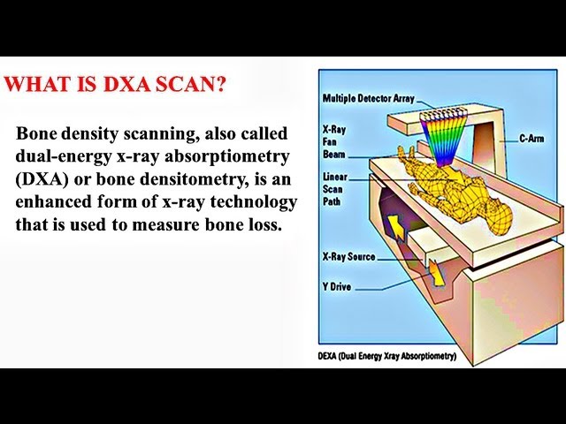You are currently viewing Bone Densitometry – Medical PowerPoint Presentation