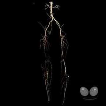 You are currently viewing CT Angiogram