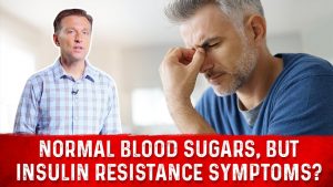 Can You Have Normal Blood Sugar And Still Be Insulin Resistant? | Dr.Berg